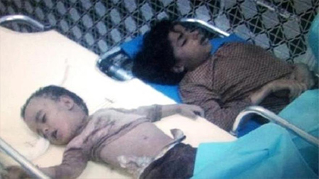 Denuncian el uso de bombas prohibidas contra civiles en Yemen